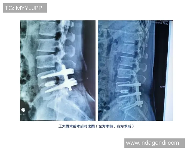 舒尔斯韧带手术后痛苦不堪各国专家无奈查不出病因 舒尔斯韧带手术后痛苦不堪各国专家无奈查不出病因